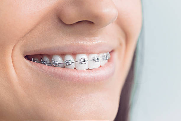 Why Choose Us for Your Dental Needs in Denham Springs, LA